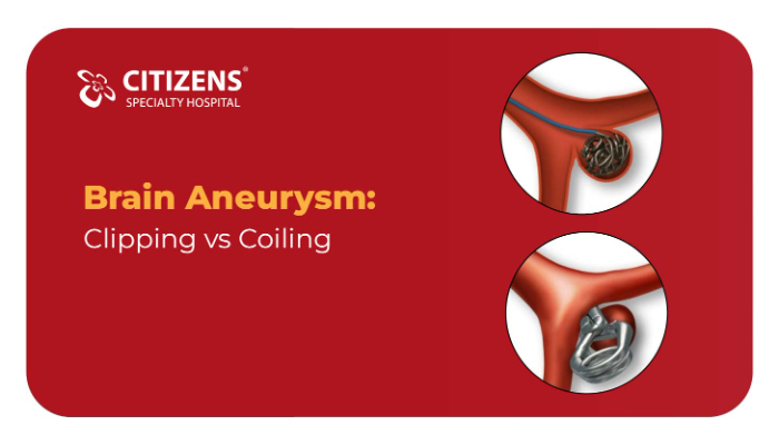 Brain Aneurysm: Clipping vs Coiling