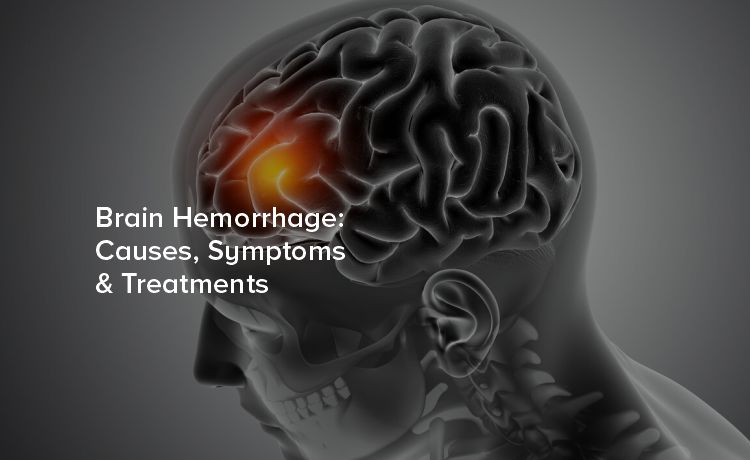 Brain Hemorrhage: Causes, Symptoms, and Treatments
