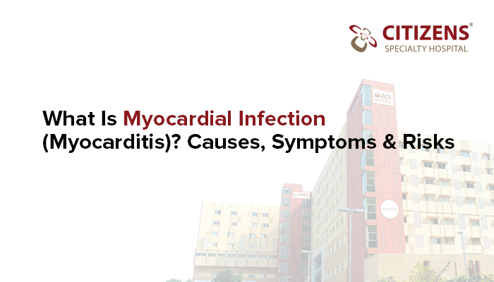 What Is Myocardial Infection (Myocarditis)? Causes, Symptoms & Risks