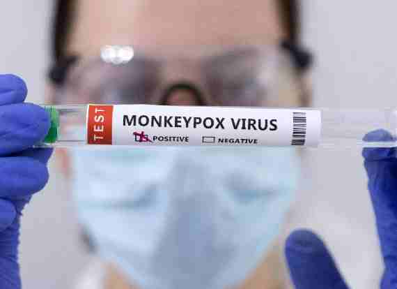 Monkeypox Virus Explained: How contagious is Monkeypox virus and how to prevent it?