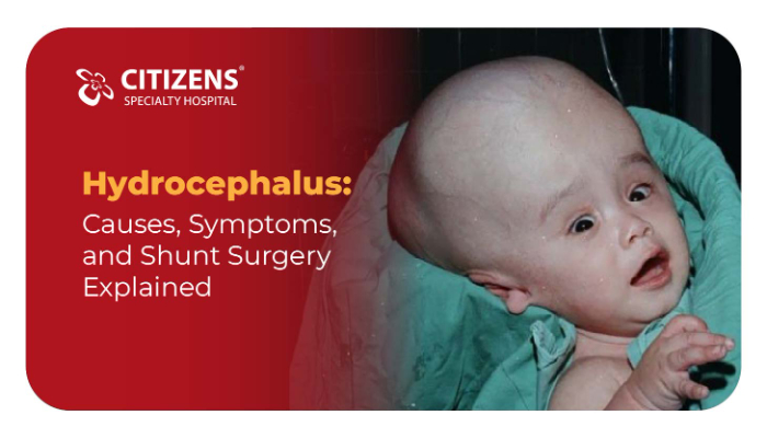 Hydrocephalus: Causes, Symptoms, and Shunt Surgery Explained