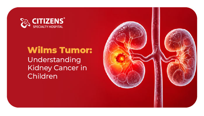 Wilms Tumor: Understanding Kidney Cancer in Children