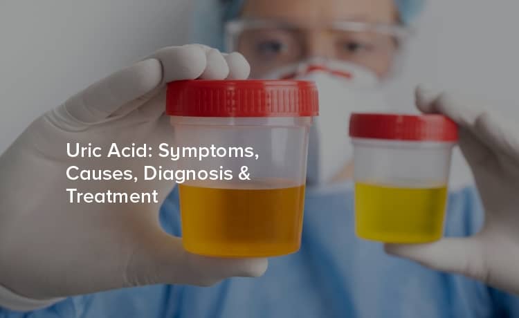 Uric Acid: Symptoms, Causes, Diagnosis & Treatment