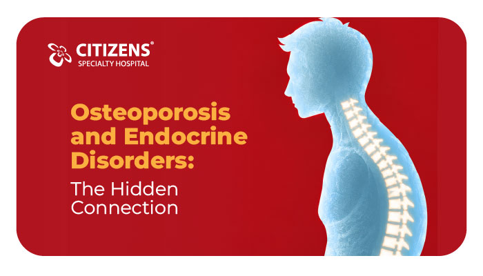 Osteoporosis and Endocrine Disorders: The Hidden Connection