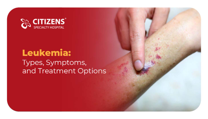 Leukemia: Types, Symptoms, and Treatment Options