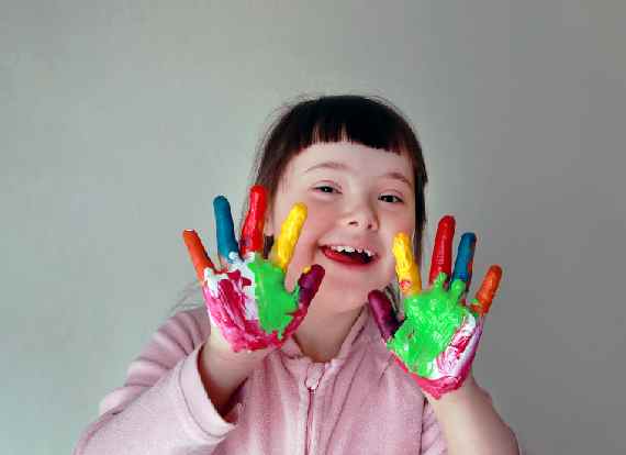 World Down Syndrome Day 2023: Quality of life of such people can improve by meeting their health care needs