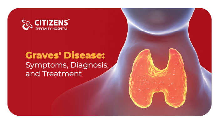 Graves’ Disease: Symptoms, Diagnosis, and Treatment